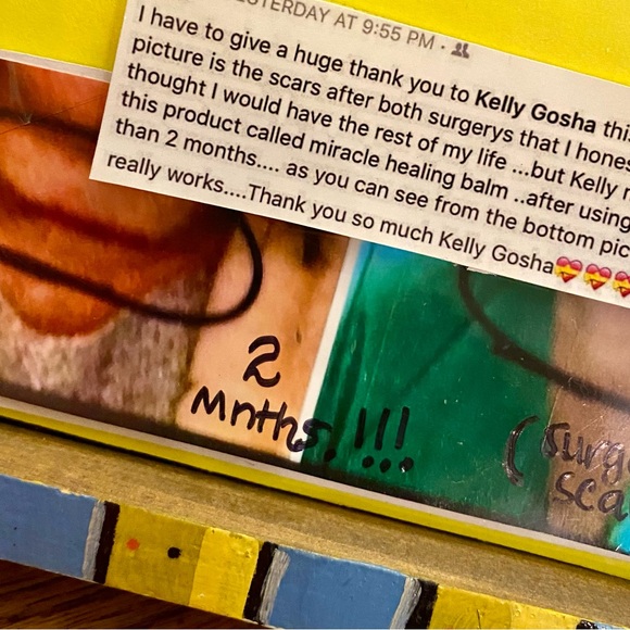 MIRACLE HEALING ❤️🩹 BALM ALL NATURAL EST 2017. FIVE STAR ⭐️ RATED… IT WORKS!! - Picture 6 of 13